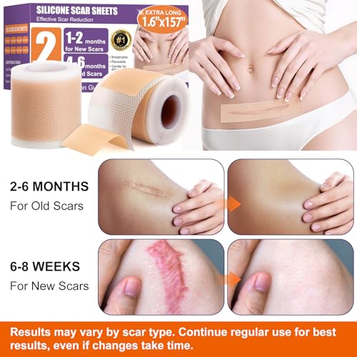 Medical-Grade Silicone Scar Tape for C-Section & Surgical Scars