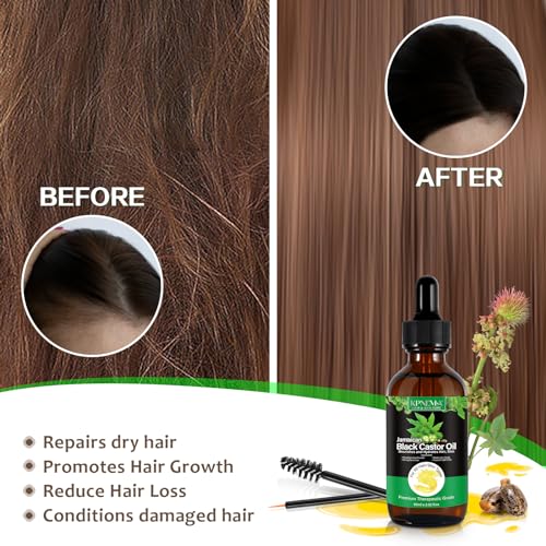 KPNEMA Jamaican Black Castor Oil for Hair Growth - 100% Natural, 2 Pack