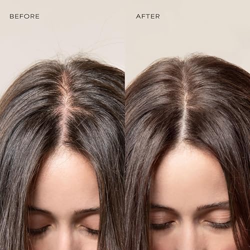 Raw Sugar Dry Scalp Treatment & Hair Care Bundle (4 Products) Intensive Ritual At Home Spa Kit, Shampoo, Conditioner, Hair Mask & Massager, Formulated without SLS/SLES & Parabens