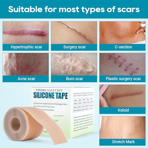 VPRIME SAFETYFY Medical-Grade Silicone Scar Tape 1.6"x 80" Roll-2M for Surgical, C-Section, Acne & Burn Scars
