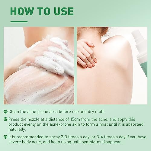 BEFIVECOK 2PCS Back Acne Spray Treatment with Herbal Formula, Salicylic Acid & Tea Tree Oil