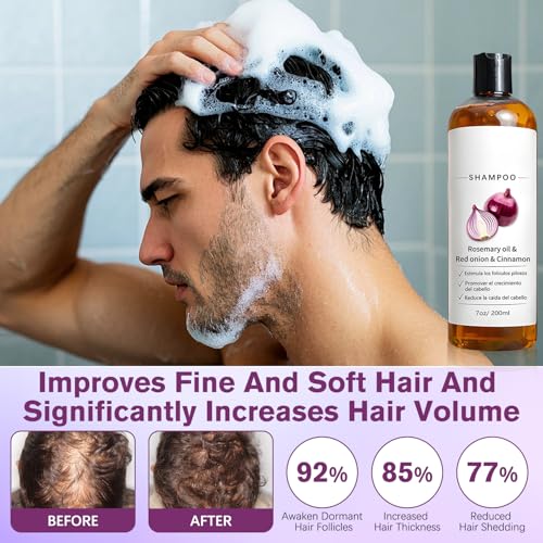 Rosemary Shampoo with Onion & Biotin for Hair Growth