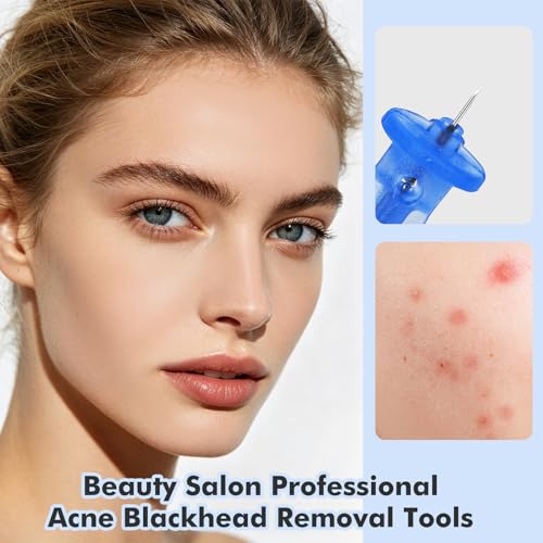 KUMarte 150 PCS Blackhead & Blemish Remover Tool Set for Acne
