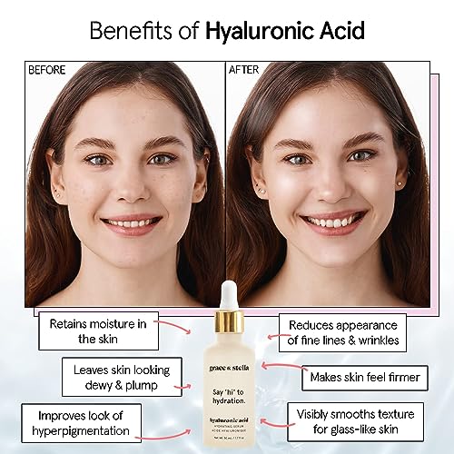 Hyaluronic Acid Serum by Grace & Stella - 10ml Anti-Aging Hydration