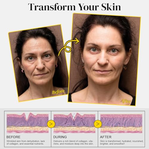 Marianp Clear Snail Mucin Forehead Wrinkle Patches - 14 Count Overnight Anti-Aging Mask Set
