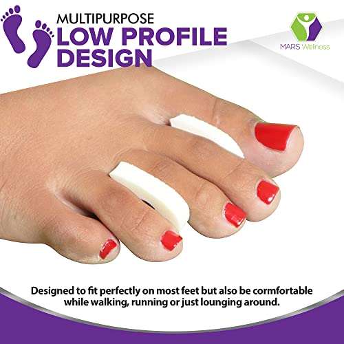 Foam Toe Separators for Foot Pain Relief - 50 Count Pack
