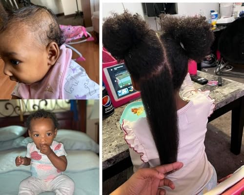 7better LLC Natural Baby & Kids Nourishing Hair Growth Serum with Black Seed Oil