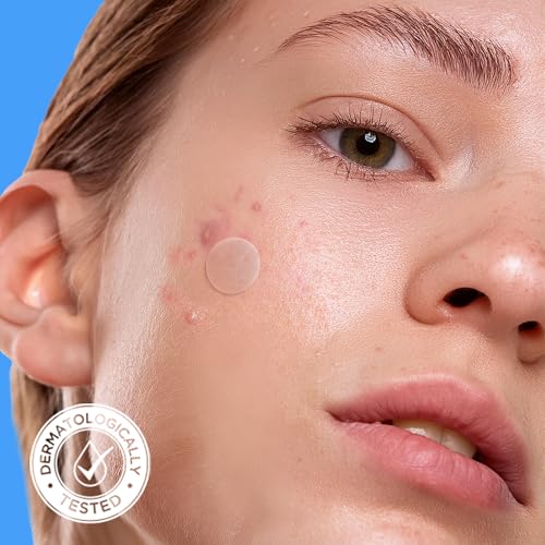 Avarelle Hydrocolloid Acne Pimple Patches with Tea Tree Oil (80 Count)