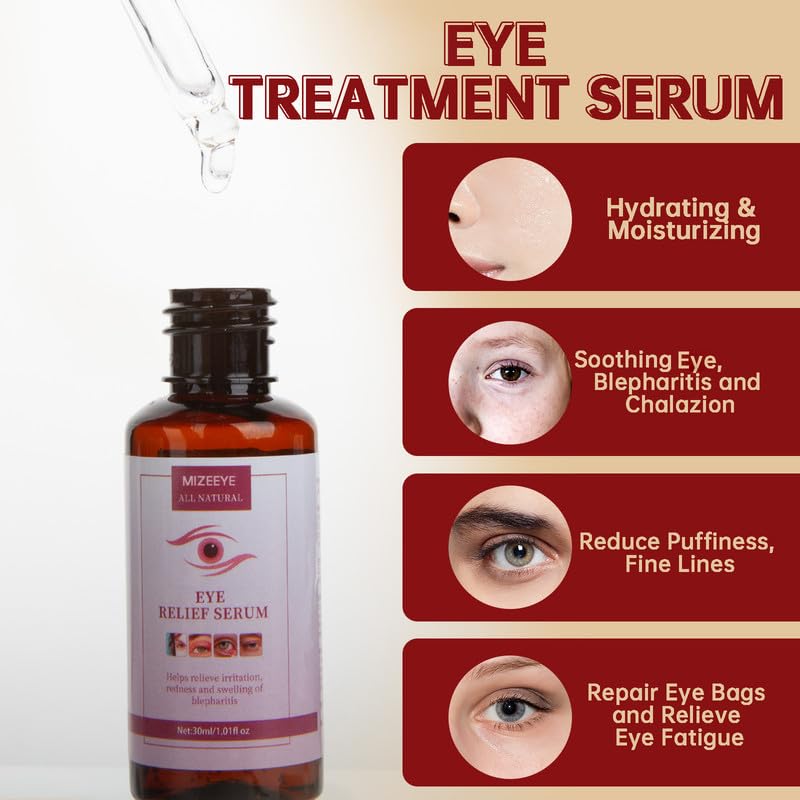 MIZEEYE 2PCS Eye Relief Serum for Blepharitis & Chalazion, Moisturizing Under Eye Care
