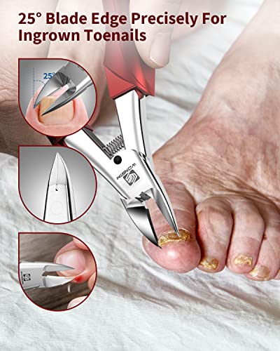 WONSIM Ingrown Toenail Clippers Set - 4Pcs Heavy Duty Stainless Steel Nail Tools for Seniors & Thick Toenails