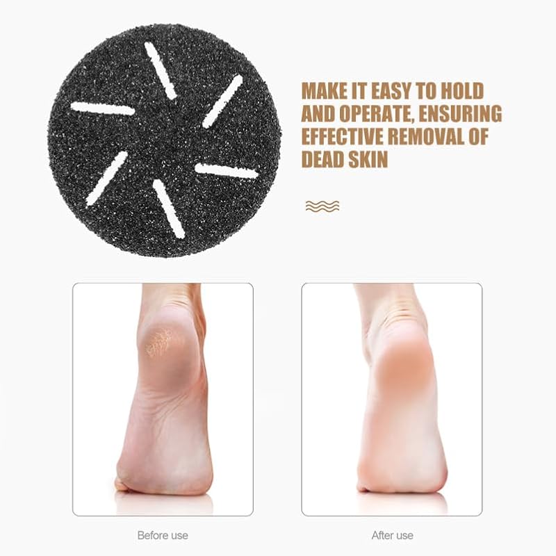 20 Pack Electric Foot Grinder Replacement Roller Heads Coarse Grit Callus Remover