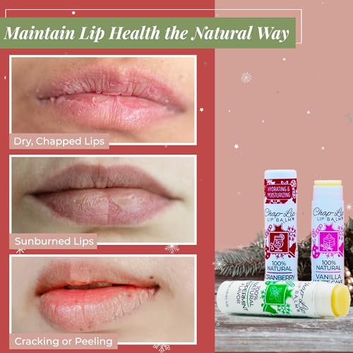 Chap-Lip 100% Natural Lip Balm Set - Holiday Collection, 24-Pack