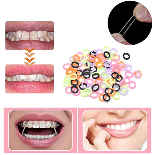 Rabbit 3/16in Multicolor Dental Orthodontic Elastics 200 Pack for Braces, Dreadlocks, Braids