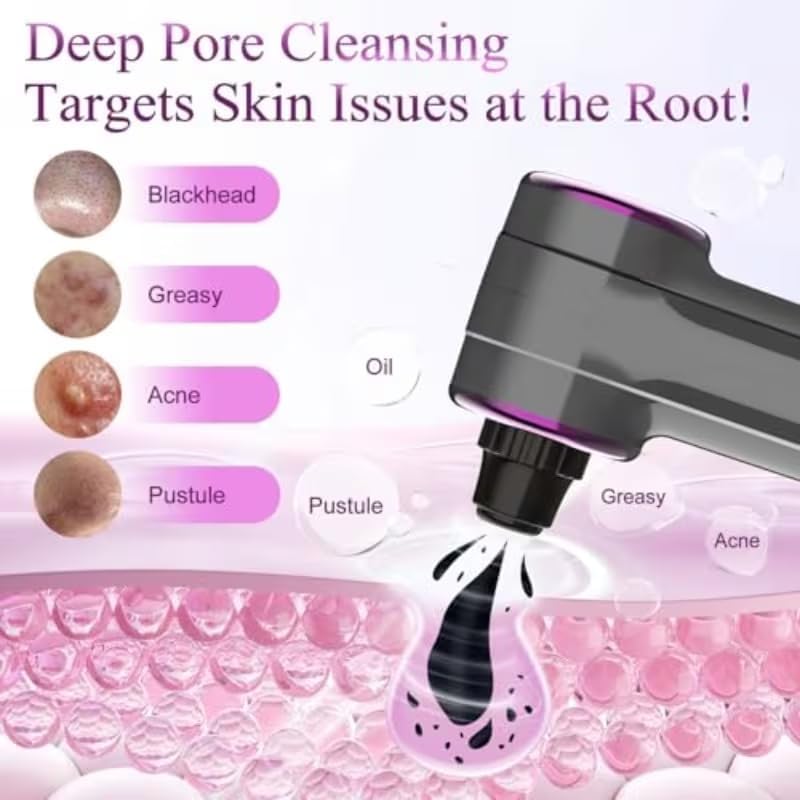 Pore Vacuum Blackhead Remover - 5 Suction Heads & 3 Levels for Deep Cleansing | Nose & Face