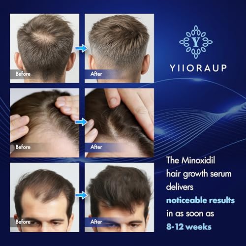 5% Minoxidil Hair Growth Treatment with Biotin - 2-Pack Topical Serum