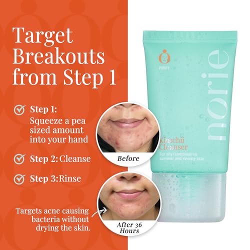 Norie Kimchii 2% Salicylic Acid Face Wash - Gentle Vegan Gel Cleanser