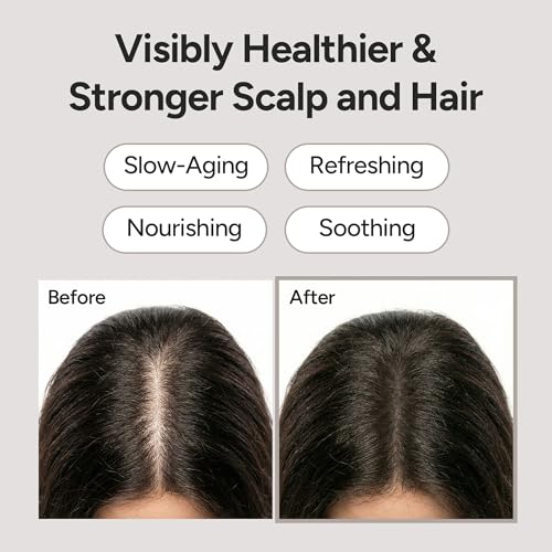BANANAL Silica 7000 Scalp Serum Roll-On for Thinning Hair, 0.5 fl oz