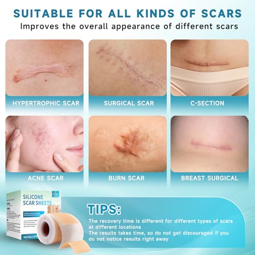 Rvlaim 3M Medical-Grade Silicone Scar Tape 1.6”x120” Reusable Sheets