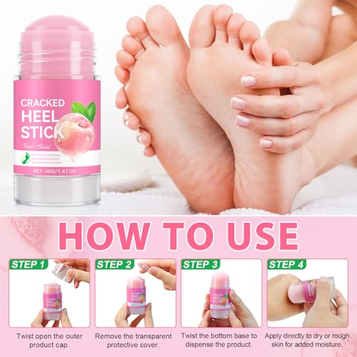 Urea Foot Callus Remover Stick - Moisturizing Heel & Skin Softening Treatment