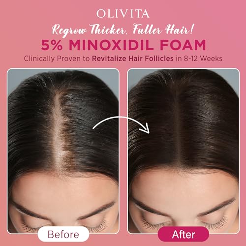 5% Minoxidil Foam for Women Hair Growth: Extra Strength Hair Regrowth Treatment ? Revitalize Hair Follicles & Regrow Thicker, Fuller Hair ? Hair Loss Solution