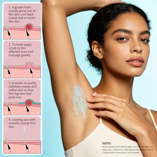 Ingrown Hair Exfoliating Scrub with AHA & BHA - KP Bump Eraser