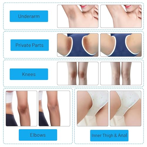Gukei Skin Whitening Cream for Intimate Areas - 60ML