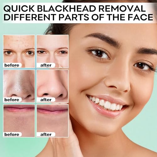 Blackhead Remover Peel Off Mask Set with Pore Strips - Easy 2-Step Acne Treatment