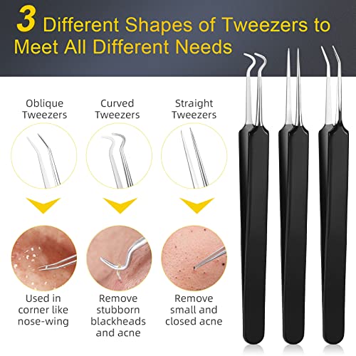 15-Piece Professional Stainless Steel Pimple Popper and Blackhead Remover Kit