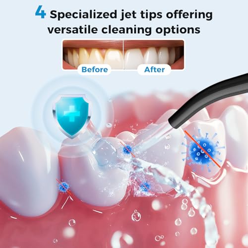 LINKEVAP Cordless Water Flosser, 360ML Portable Oral Irrigator for Teeth