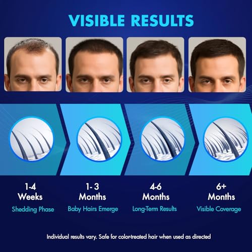 5% Minoxidil Hair Growth Treatment with Biotin - 2-Pack Topical Serum