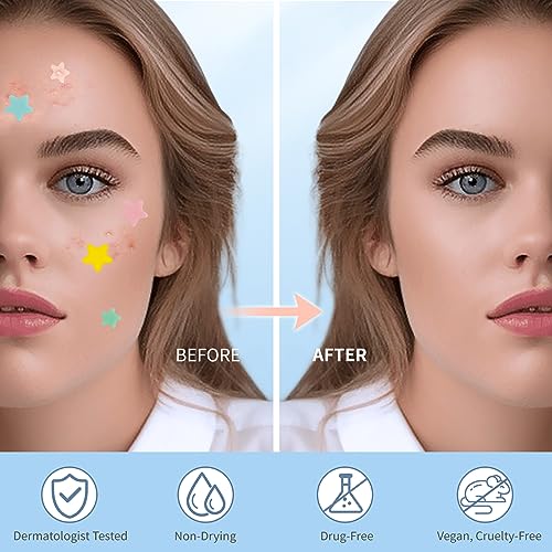 QUSTERE Pimple Patches for Face - 800 Count Hydrocolloid Acne Stickers in 10 Colors