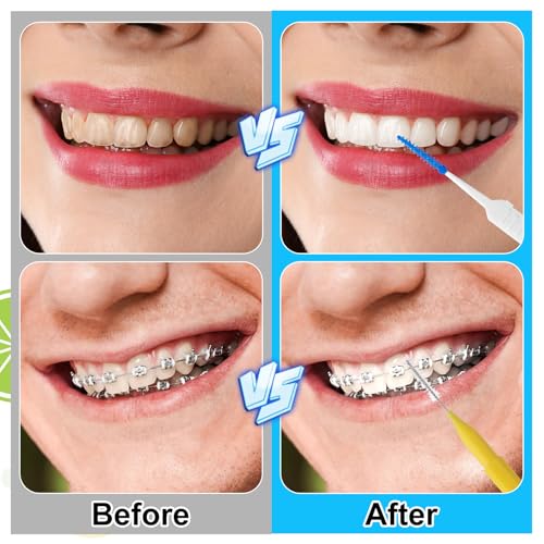 355-Piece Interdental Brush and Floss Pick Set for Braces - Multicolor