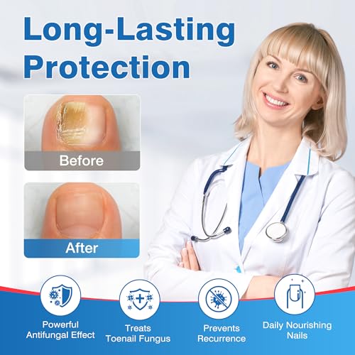 DR.RAPID Toenail Fungus Treatment Pen - Extra Strength, 1 Fl Oz (Pack of 3) with 25% Undecylenic Acid