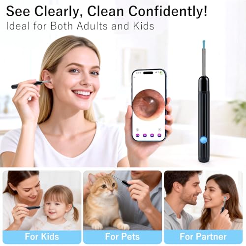 AudScope Black 1080P HD Ear Camera & Wax Removal Kit with LED Lights for Adults & Kids