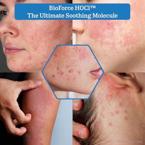 NueVue Hypochlorous Acid Face & Body Spray - Gentle Skin Cleanser & Toner, pH Balanced, 4 oz