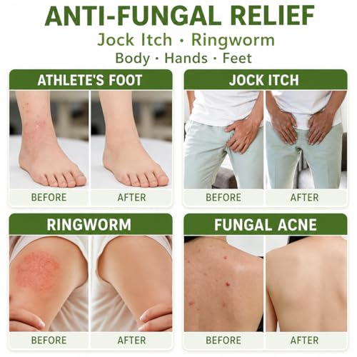 BIGBIO 3-Pack Green Tea Tree Soap Bars 10.59oz - Natural Anti-Fungal Body & Foot Odor Control