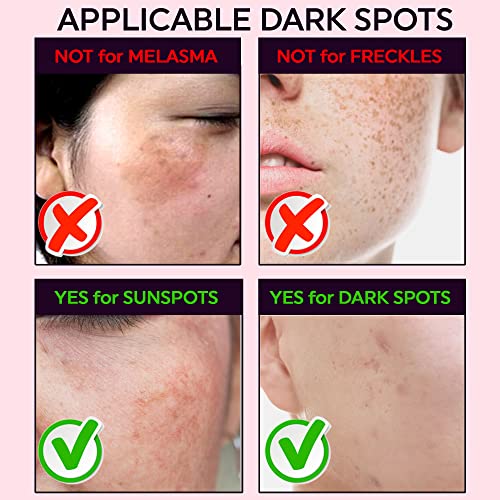 Microdart Dark Spot Patch - 9 Count Acne Treatment for Clearer Skin