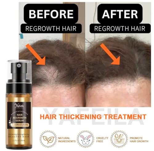 Hair Growth Spray for Stronger Hair & Beard – Natural DHT Blocker