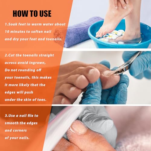 LePinko Professional Toenail Clippers for Thick and Ingrown Nails - 1 Piece