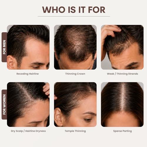 S¨ªREN Micro Infusion Hair Renewal System by SOREN ? Saw Palmetto & Peptide Scalp Treatment Kit | Supports Fuller, Thicker-Looking Hair | Gold Microinfuse Applicator | 3 Month Supply