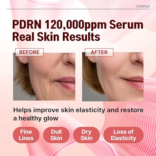 CELDYQUE PDRN 12% Anti-Aging Face Serum with Salmon DNA, Growth Factors & Hyaluronic Acid