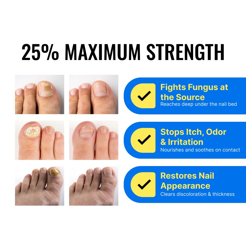 Fungix with Undecylenic Acid - Nail Solution - by Approved Science