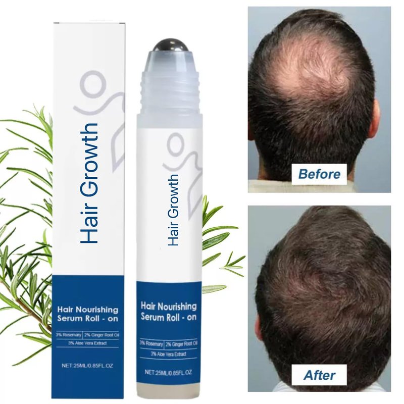 Rosemary Hair Growth Serum Roll-On | 3% Rosemary & Ginger Oil for Thicker, Fuller Hair - Hair Loss Treatment