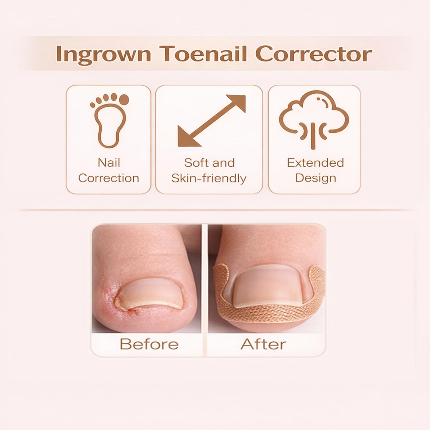 Ingrown Toenail Corrector & Toenail Correction Kit with Soft Breathable Strips, Stainless Steel Tools and Elastic Fiber Toe Sleeves; Ideal for Runners, Long-Hour Workers and Tight-Shoe Wearers