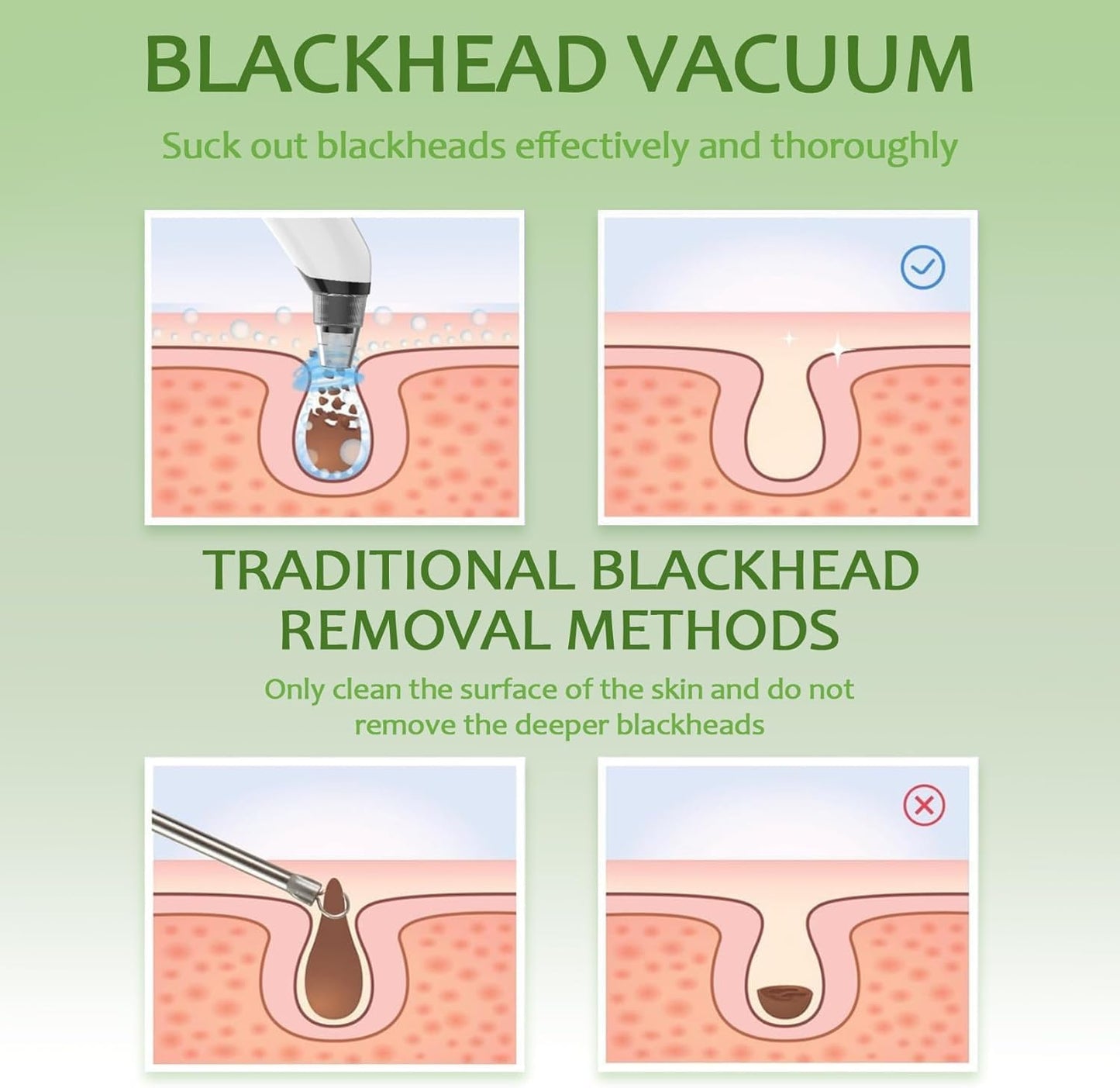 Blackhead Remover Pore Vacuum - Electric Facial Cleanser with 4 Probes & 3 Suction Levels | USB Rechargeable, White