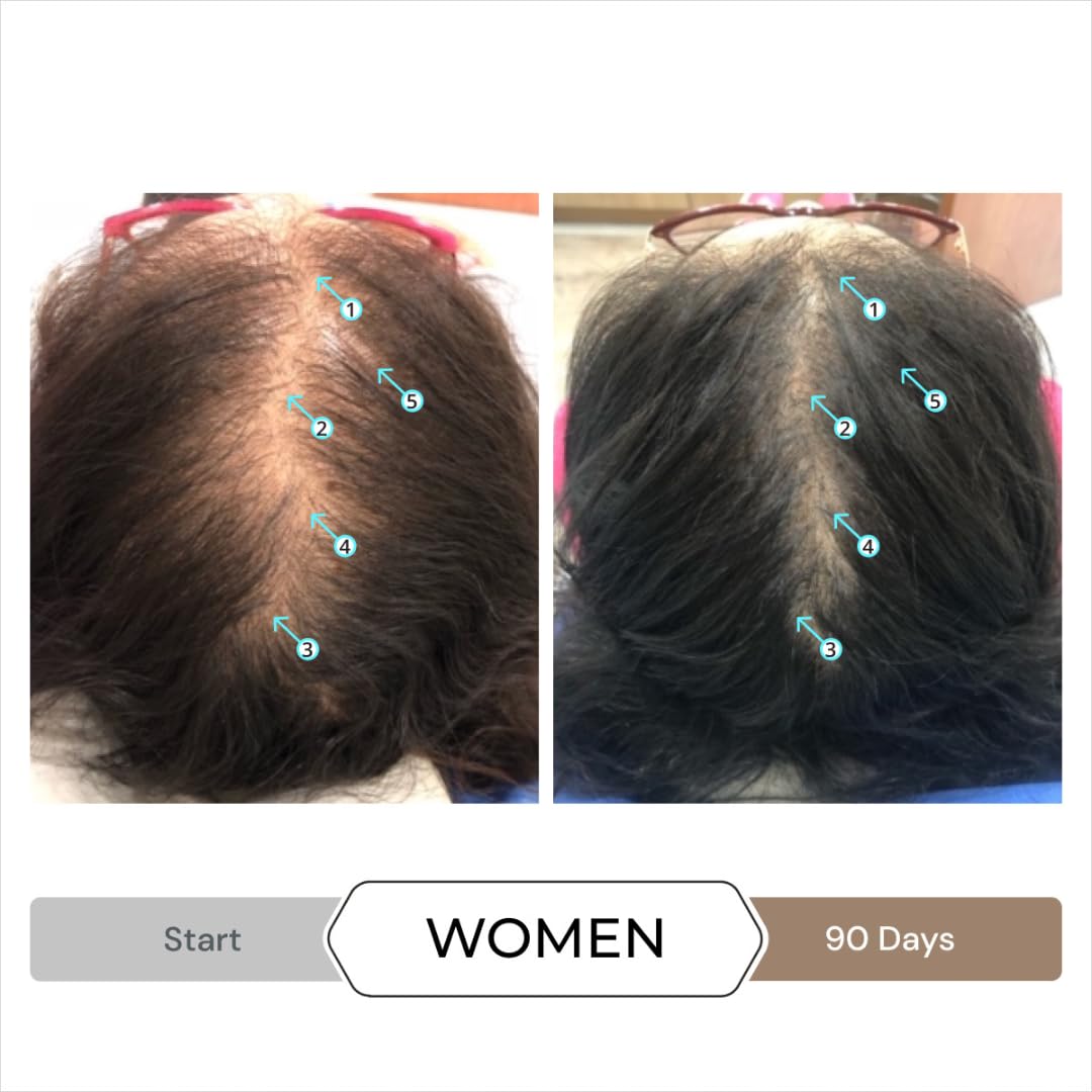 Spectral Hair Density Serum for Men - Strengthening & Thickening Leave-In Treatment | 60mL