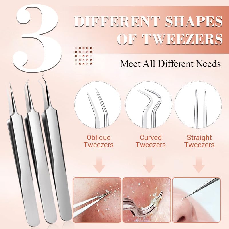 Aocesk 7-Piece Blackhead Removal Tool Kit - Acne Extractor Set