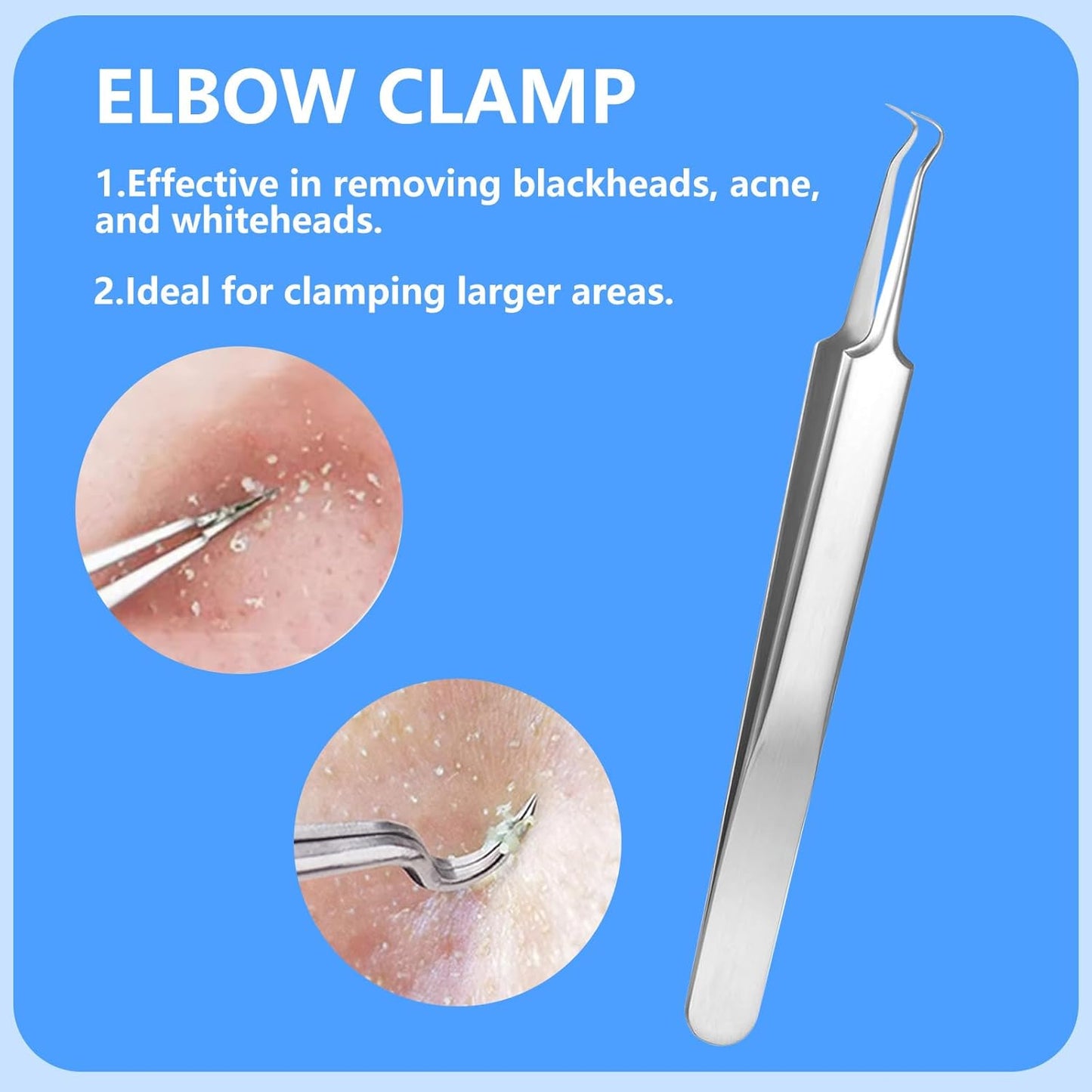 Blackhead Remover Kit - 5PCS Professional Stainless Steel Comedone Extractors for Acne & Blemish Removal | Curved Tweezers Included