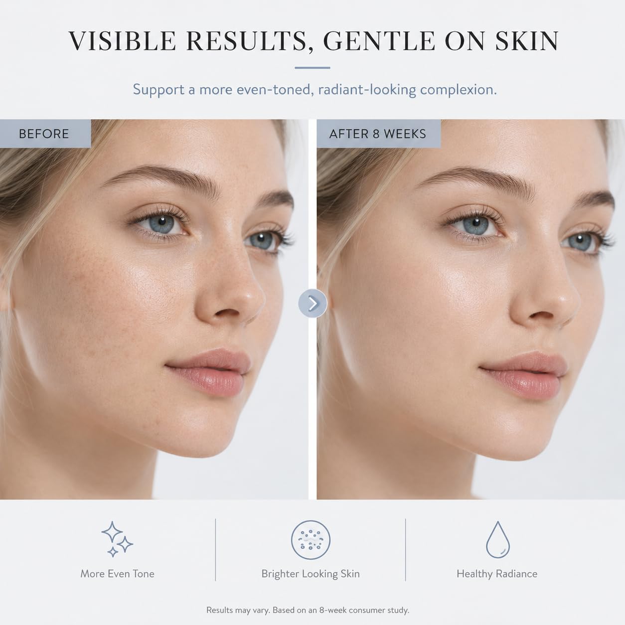 Dark Spot Remover Serum - 20,000ppm Niacinamide & Tranexamic Acid for Face & Body | Brightens Age Spots & Uneven Tone (1 FL.OZ)