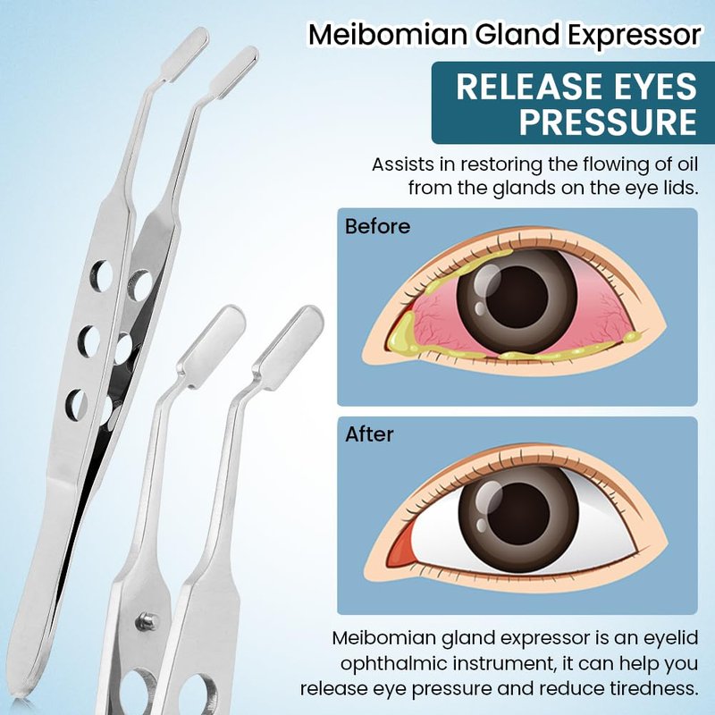 Meibomian Gland Expressor, Stainless Steel Eyelid Massage Tweezers, Professional Forceps Dryeye Extraction Tool for Men Women, Eye Care Tool For Dry Eyes(Square Tip,SIZE:3 * 10)